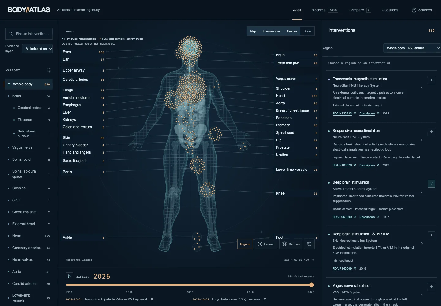 BODY//ATLAS prototype: anatomical intervention map and original-source evidence panel